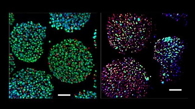 A side-by-side comparison of cells supported by the oxygenation device (left) and cells without the device support (right). 