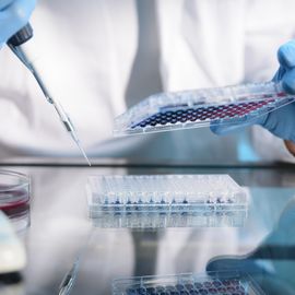 A scientist loading samples into a microwell plate. 