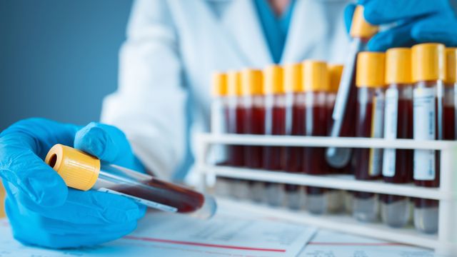 A scientist holds a blood sample. 