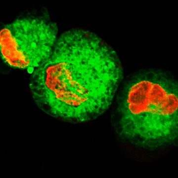 CAR-T Target Luciferase Reporter Cells