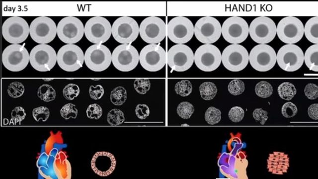 Cardioids Reveal Self-Organizing Principles of Human Cardiogenesis content piece image 