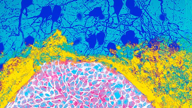 Cell Culture Medium 