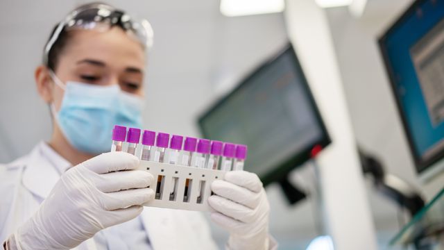 A scientist holding a rack of biosamples. 