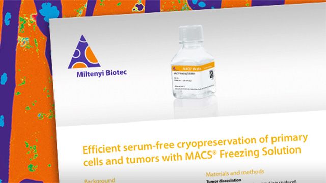 Cryopreservation miltenyi 