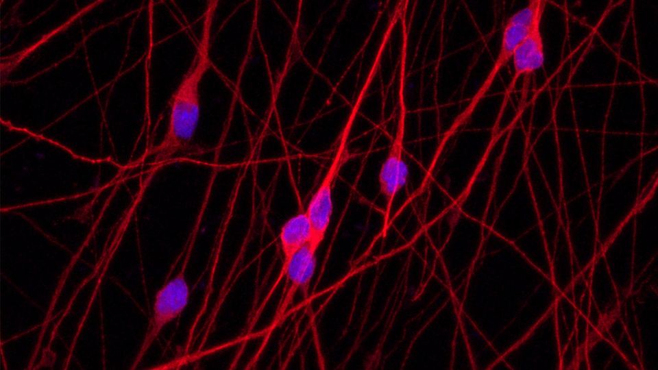 Four Hacks for Culturing Neurons content piece image