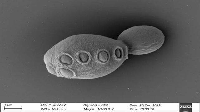 A synthetic strain of yeast. 