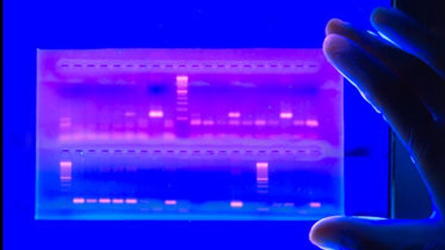 How To Improve and Simplify Your Electrophoresis Workflow content piece image 