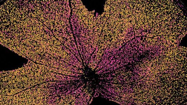 Imaging and AI-Assisted Analysis of Retinal Cell Damage content piece image 