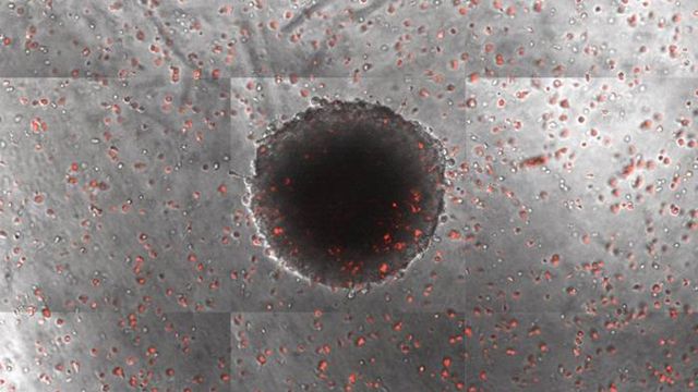 Macrophages infiltrating a tumor spheroid. 