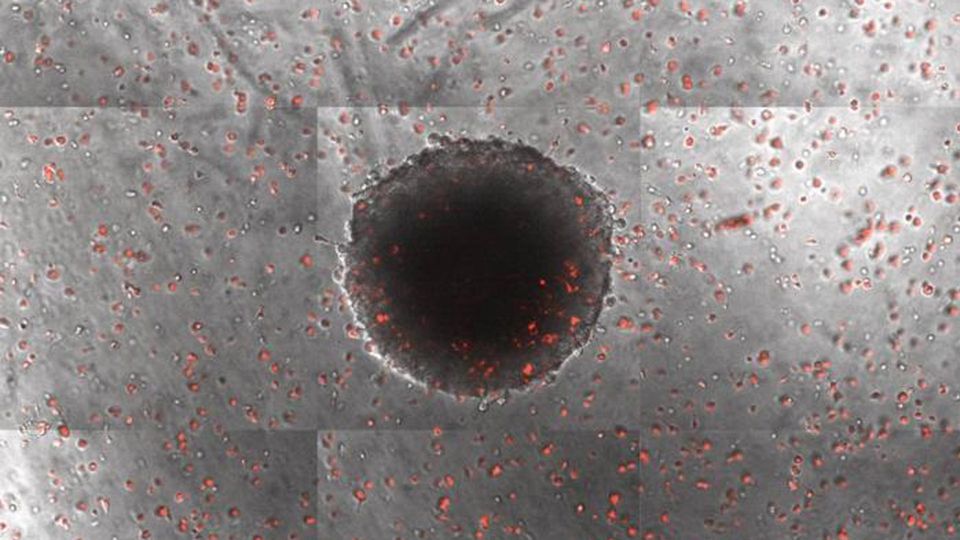 Macrophages infiltrating a tumor spheroid.