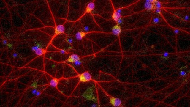 Modeling Neurodegeneration Using a Human Isogenic System content piece image 