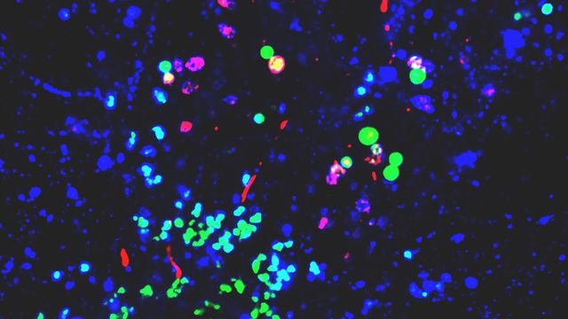 Colored nanoparticles under a microscope. 