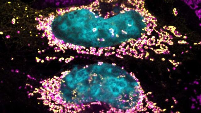 Human cells under fluorescent microscope. 