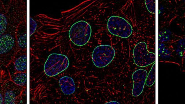 Organelle Marker Selection Guide Poster content piece image 