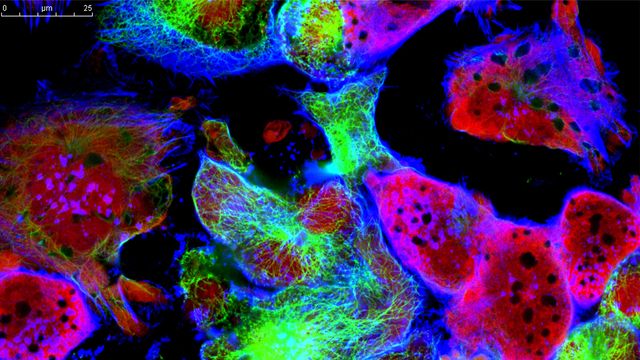 Different components of cells stained in varying colors. A scalebar in the top left corner can be seen. 