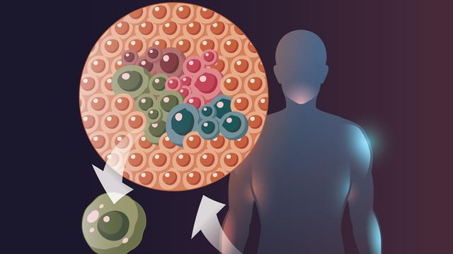 Spatial Transcriptomics in Cancer content piece image 