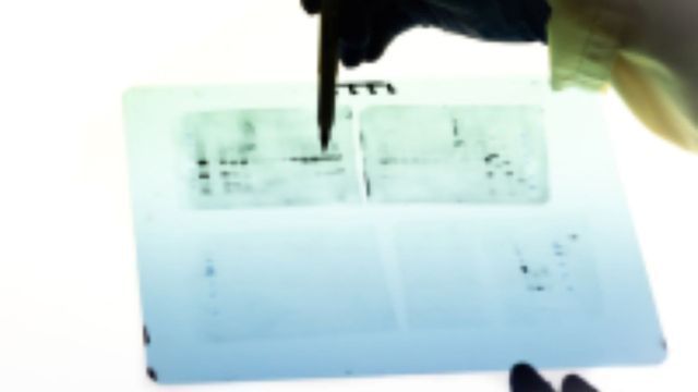 Western Blot Procedures, Analysis and Purpose content piece image 