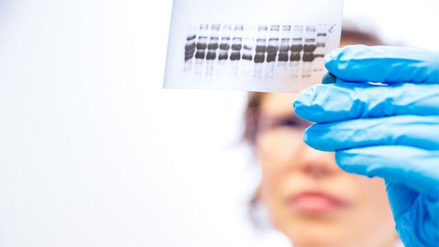 Western Blot Troubleshooting Tips content piece image 